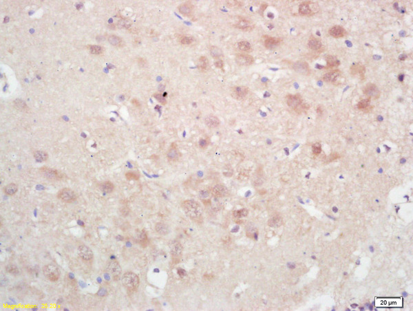 Formalin-fixed and paraffin embedded rat brain labeled with Rabbit Anti GPAM Polyclonal Antibody, Unconjugated (bs-5063R) at 1:200 followed by conjugation to the secondary antibody and DAB staining