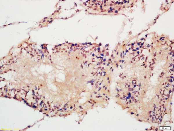 Formalin-fixed and paraffin-embedded Rat Testis labeled with Rabbit ACF1 Polyclonal Antibody, Unconjugated (bs-6476R) at 1:200 followed by secondary antibody, DAB and counterstaining.