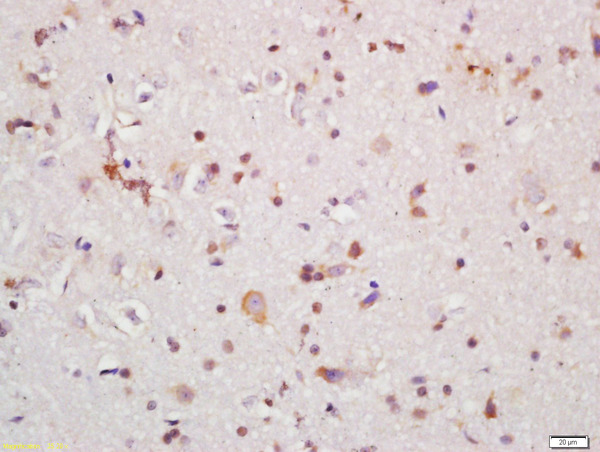 Formalin-fixed and paraffin embedded rat brain labeled with Rabbit Anti-IRAK1 Polyclonal Antibody, Unconjugated (bs-6464R) at 1:200 followed by conjugation to the secondary antibody and DAB staining\\n