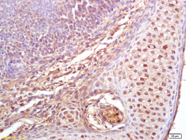 Formalin-fixed and paraffin embedded mouse embryo labeled with Rabbit Anti phospho-Cdc25B (Ser323)Polyclonal Antibody, Unconjugated (bs-5243R) at 1:200 followed by conjugation to the secondary antibody and DAB staining Formalin-fixed and paraffin embedded mouse embryo labeled with Rabbit Anti phospho-Cdc25B (Ser323)Polyclonal Antibody, Unconjugated (bs-5243R) at 1:200 followed by conjugation to the secondary antibody and DAB staining