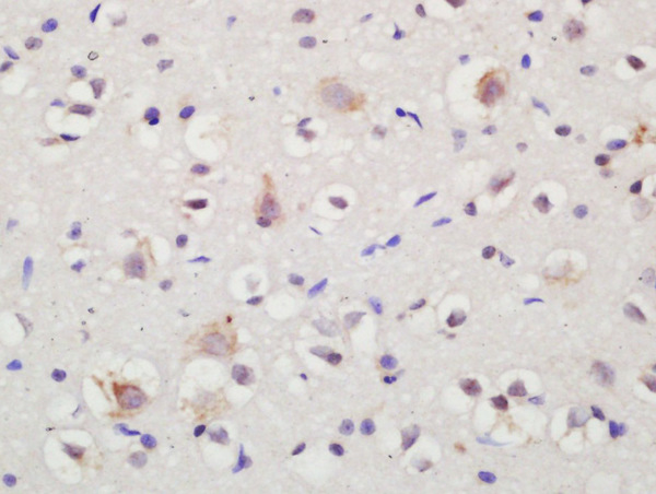 Formalin-fixed and paraffin embedded rat brain labeled with Rabbit Anti-NTR3 Polyclonal Antibody, Unconjugated (bs-6329R) at 1:200 followed by conjugation to the secondary antibody and DAB staining
