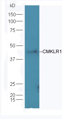 Mouse brain lysates probed with Anti-CMKLR1 Polyclonal Antibody (bs-10183R) at 1:300 overnight in 4˚C. Followed by conjugation to the secondary antibody (bs-0295G-HRP) at 1:5000 90min in 37˚C.