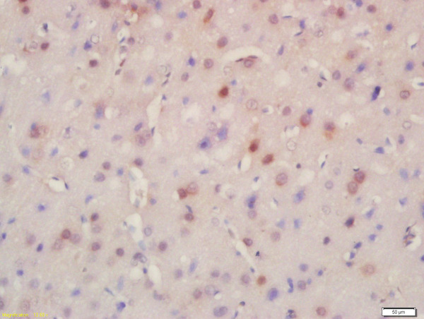 Formalin-fixed and paraffin embedded rat brain labeled with Rabbit Anti-BRD8 Polyclonal Antibody, Unconjugated (bs-6290R) at 1:200 followed by conjugation to the secondary antibody and DAB staining