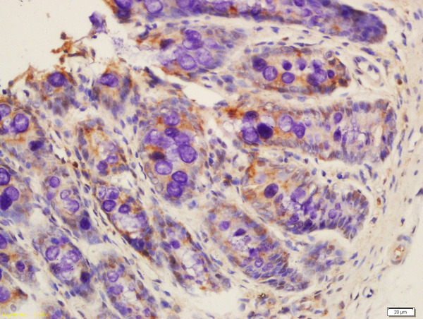 Formalin-fixed and paraffin embedded rat colon labeled with Rabbit Anti-PRSS10 Polyclonal Antibody, Unconjugated (bs-6285R) at 1:200 followed by conjugation to the secondary antibody and DAB staining