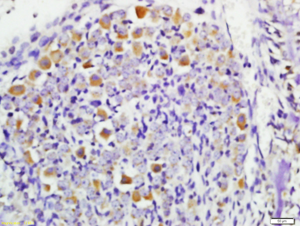 Formalin-fixed and paraffin embedded mouse embryo labeled with Rabbit Anti-STK38 Polyclonal Antibody, Unconjugated (bs-6257R) at 1:200 followed by conjugation to the secondary antibody and DAB staining