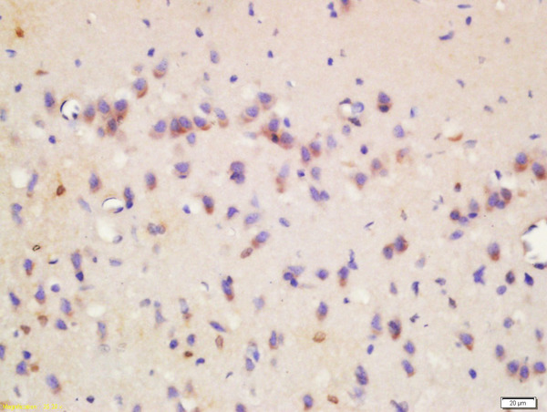 Formalin-fixed and paraffin embedded rat brain labeled with Rabbit Anti-Wnt8b Polyclonal Antibody, Unconjugated (bs-6245R) at 1:200 followed by conjugation to the secondary antibody and DAB staining