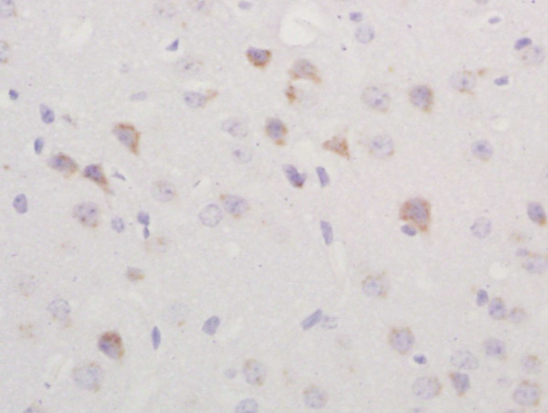 Formalin-fixed and paraffin embedded rat brain labeled with Rabbit Anti-TGM2 Polyclonal Antibody, Unconjugated (bs-6196R) at 1:200 followed by conjugation to the secondary antibody and DAB staining