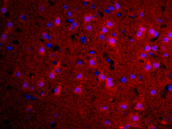 Formalin-fixed and paraffin embedded rat brain labeled with Rabbit Anti-TGM2 Polyclonal Antibody, Unconjugated (bs-6196R) at 1:200 followed by conjugation to the secondary antibody Goat Anti-Rabbit IgG, Cy3 conjugated(bs-0295G-Cy3)used at 1:200 dilution for 40 minutes at 37°C\n