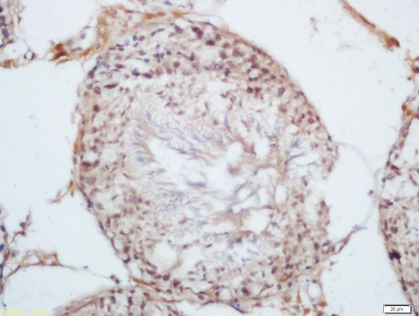 Formalin-fixed and paraffin embedded rat testis labeled with Rabbit Anti-KDM5B Polyclonal Antibody, Unconjugated (bs-6139R) at 1:200 followed by conjugation to the secondary antibody and DAB staining\n