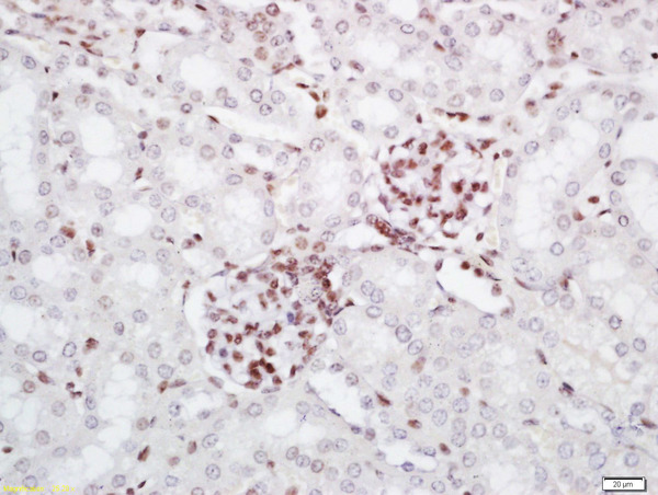 Formalin-fixed and paraffin embedded mouse kidney labeled with Rabbit Anti-PRMT6 Polyclonal Antibody, Unconjugated (bs-6063R) at 1:200 followed by conjugation to the secondary antibody and DAB staining\n