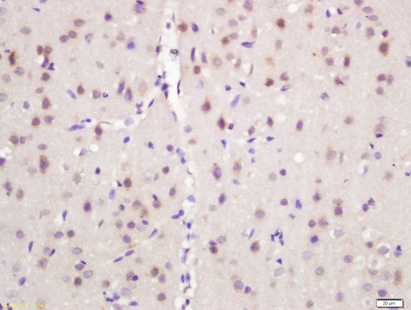 Formalin-fixed and paraffin embedded mouse brain labeled with Rabbit Anti-NARC1 Polyclonal Antibody, Unconjugated (bs-6060R) at 1:200 followed by conjugation to the secondary antibody and DAB staining\n