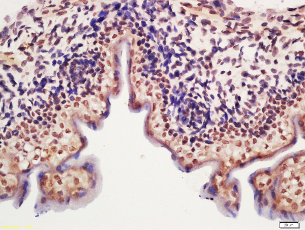 Formalin-fixed and paraffin embedded mouse embryo labeled with Rabbit Anti-METTL11A Polyclonal Antibody, Unconjugated (bs-6057R) at 1:200 followed by conjugation to the secondary antibody and DAB staining\n Formalin-fixed and paraffin embedded mouse embryo labeled with Rabbit Anti-METTL11A Polyclonal Antibody, Unconjugated (bs-6057R) at 1:200 followed by conjugation to the secondary antibody and DAB staining\n