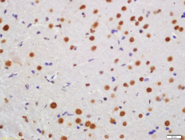 Formalin-fixed and paraffin embedded rat brain labeled with Rabbit Anti-KLHL7 Polyclonal Antibody, Unconjugated (bs-5935R) at 1:200 followed by conjugation to the secondary antibody and DAB staining