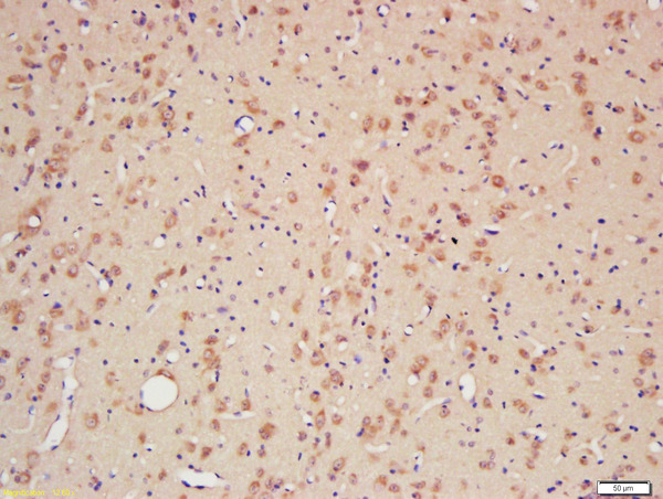 Formalin-fixed and paraffin embedded rat brain labeled with Rabbit Anti-CYPA Polyclonal Antibody, Unconjugated (bs-5912R) at 1:200 followed by conjugation to the secondary antibody and DAB staining