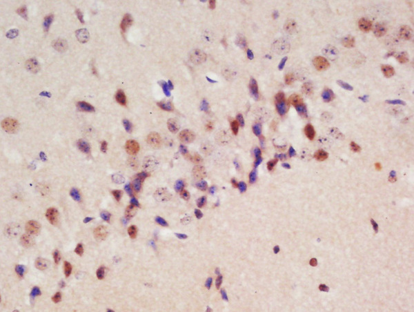 Formalin-fixed and paraffin embedded rat brain labeled with Rabbit Anti-Drebrin Polyclonal Antibody, Unconjugated (bs-5835R) at 1:200 followed by conjugation to the secondary antibody and DAB staining