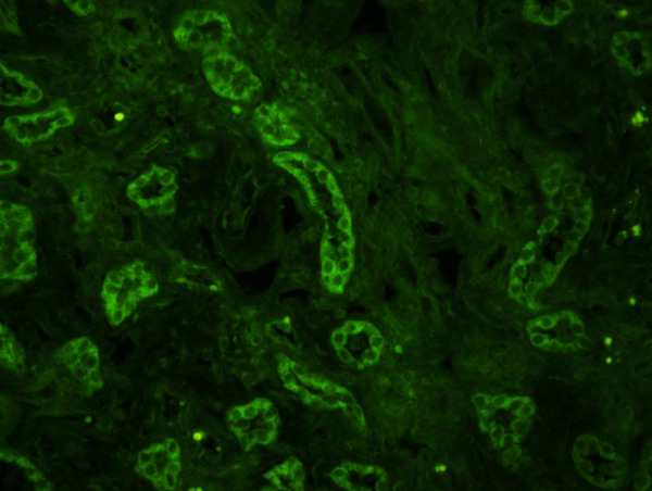 Formalin-fixed and paraffin embedded human kidney labeled with Rabbit Anti-Mitofusin 2 Polyclonal Antibody, Unconjugated (bs-2988R) at 1:200 followed by Goat Anti-Rabbit IgG, FITC conjugated(bs-0295G-FITC)used at 1:200 dilution for 40 minutes at 37°C.