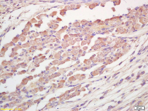 Formalin-fixed and paraffin embedded mouse embryo labeled with Rabbit Anti TRAK1 Polyclonal Antibody, Unconjugated (bs-5536R) at 1:200 followed by conjugation to the secondary antibody and DAB staining