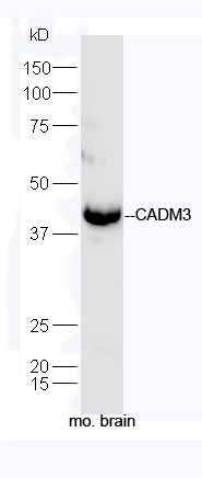 Mouse brain lysates probed with Rabbit Anti-CADM3 Polyclonal Antibody, Unconjugated (bs-6027R) at 1:300 overnight at 4˚C. Followed by a conjugated secondary antibody (bs-0295G-HRP) at 1:5000 for 90 min at 37˚C.