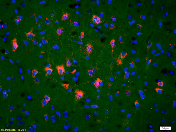 Formalin-fixed and paraffin-embedded rat brain labeled with Anti-TRAK1 Polyclonal Antibody, Unconjugated(bs-5536R) 1:200, overnight at 4°C, The secondary antibody was Goat Anti-Rabbit IgG, Cy3 conjugated(bs-0295G-Cy3)used at 1:200 dilution for 40 minutes at 37°C.