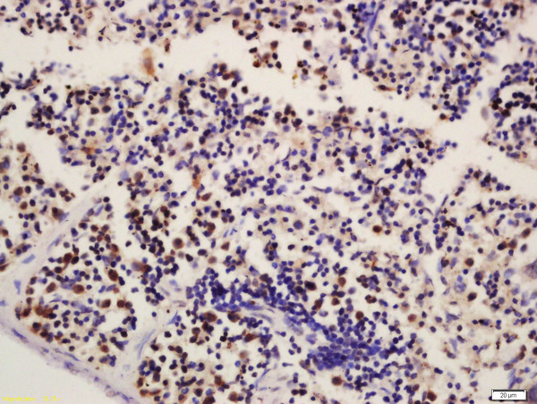 Formalin-fixed and paraffin embedded mouse spleen labeled with Rabbit Anti-HCLS1 Polyclonal Antibody, Unconjugated (bs-5109R) at 1:200 followed by conjugation to the secondary antibody and DAB staining