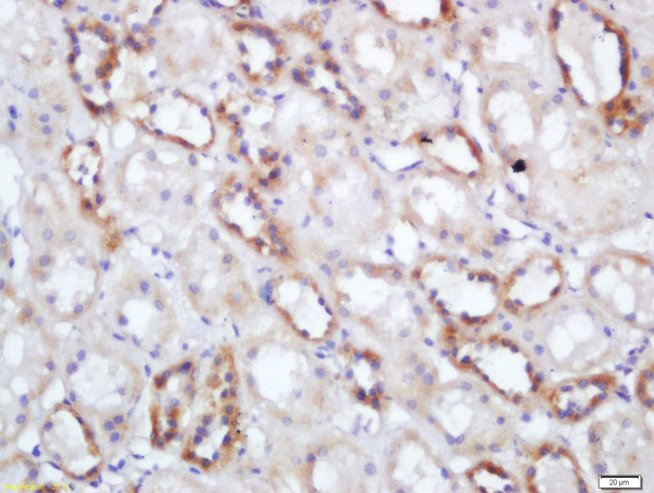Formalin-fixed and paraffin embedded human kidney labeled with Rabbit Anti-NNT Polyclonal Antibody, Unconjugated (bs-5097R) at 1:200 followed by conjugation to the secondary antibody and DAB staining