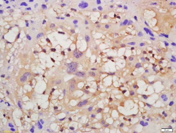 Formalin-fixed and paraffin embedded mouse placenta tissue labeled with Anti-VEGFR2 Polyclonal Antibody, Unconjugated (bs-10412R) at 1:200 followed by conjugation to the secondary antibody and DAB staining.