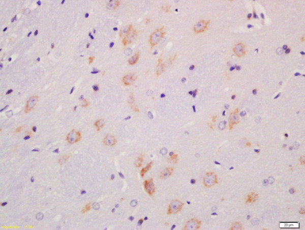 Formalin-fixed and paraffin embedded rat brain labeled with Anti-MST4 + MST3 + STK25 (Thr178 + Thr190 + Thr174) Polyclonal Antibody, Unconjugated (bs-10441R) at 1:200 followed by conjugation to the secondary antibody and DAB staining
