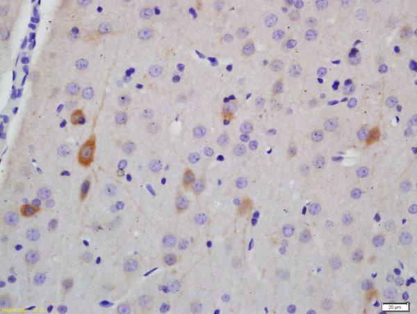 Formalin-fixed and paraffin embedded rat brain labeled with Anti-NF-H Polyclonal Antibody, Unconjugated (bs-10680R) at 1:200 followed by conjugation to the secondary antibody and DAB staining