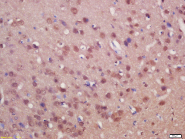 Formalin-fixed and paraffin embedded rat brain labeled with Anti-SUFU/Suppressor of Fused Polyclonal Antibody, Unconjugated (bs-11209R) at 1:200 followed by conjugation to the secondary antibody and DAB staining Formalin-fixed and paraffin embedded rat brain labeled with Anti-SUFU/Suppressor of Fused Polyclonal Antibody, Unconjugated (bs-11209R) at 1:200 followed by conjugation to the secondary antibody and DAB staining