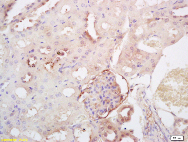 Formalin-fixed and paraffin embedded rat kidney labeled with Rabbit Anti SULT2A1 Polyclonal Antibody, Unconjugated (bs-5664R) at 1:200 followed by conjugation to the secondary antibody and DAB staining