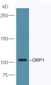Mouse brain lysates probed with Anti-ORP1 Polyclonal Antibody, Unconjugated (bs-17514R) at 1:300 in 4˚C. Followed by conjugation to secondary antibody (bs-0295G-HRP) at 1:5000 90min in 37˚C.