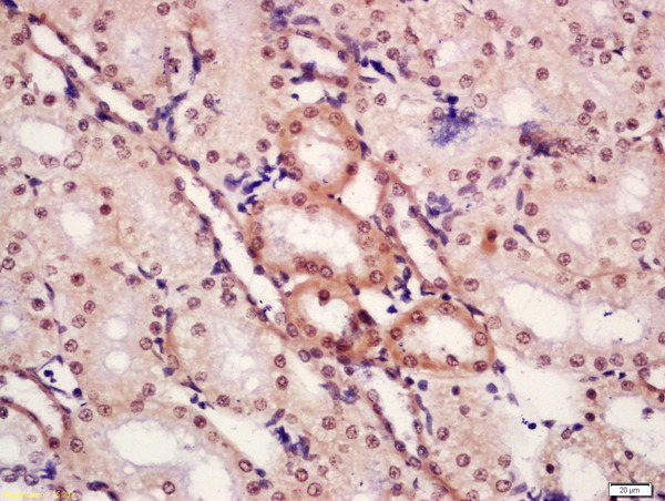 Formalin-fixed and paraffin embedded rat kidney tissue labeled with Anti-CTBP1 (Ser422) Polyclonal Antibody, Unconjugated (bs-11275R) at 1:300 followed by conjugation to the secondary antibody and DAB staining.