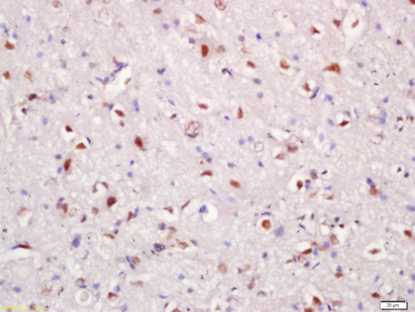 Formalin-fixed and paraffin embedded rat brain tissue labeled with Rabbit Anti-Hrk Polyclonal Antibody, Unconjugated (bs-10302R) at 1:200 followed by conjugation to the secondary antibody and DAB staining