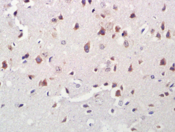 Formalin-fixed and paraffin embedded rat brain labeled with Anti-A2LD1/GGACT Polyclonal Antibody, Unconjugated (bs-11381R) at 1:300 followed by conjugation to the secondary antibody and DAB staining.