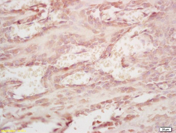Formalin-fixed and paraffin embedded mouse embryo labeled with Rabbit Anti MMP20 Polyclonal Antibody, Unconjugated (bs-5788R) at 1:200 followed by conjugation to the secondary antibody and DAB staining
