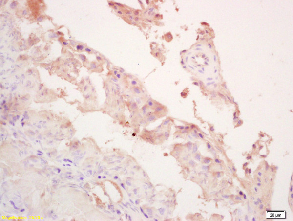 Formalin-fixed and paraffin embedded rat testis labeled with Rabbit Anti LOXL4 Polyclonal Antibody, Unconjugated (bs-5790R) at 1:200 followed by conjugation to the secondary antibody and DAB staining Formalin-fixed and paraffin embedded rat testis labeled with Rabbit Anti LOXL4 Polyclonal Antibody, Unconjugated (bs-5790R) at 1:200 followed by conjugation to the secondary antibody and DAB staining