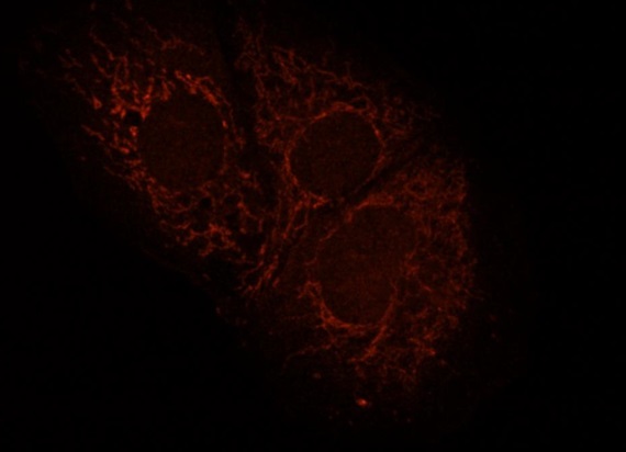 Human HepG2 cells fixed with 3.7% Formaldehyde in medium, blocking performed with 10% NGS in 1x PBS buffer + 0.1% Tween20. Incubated with Anti-Mitofilin/IMMT Polyclonal Antibody (bs-1824R) at a 1:10 dilution for 1hr at RT, followed by Anti-Rabbit secondary, Cy3 conjugate at a 1:300 dilution incubated at RT for 1hr. This image was kindly provided by an end-user.