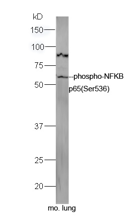 Mouse lung lysates probed with Rabbit Anti-NFkB p65 (Ser536) Polyclonal Antibody, Unconjugated (bs-0982R) at 1:300 overnight at 4˚C. Followed by a conjugated secondary antibody (bs-0295G-HRP) at 1:5000 for 90 min at 37˚C.