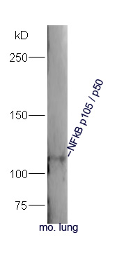 Mouse lung lysates probed with Rabbit Anti-NFkB p105\/p50 Polyclonal Antibody, Unconjugated (bs-1194R) at 1:300 overnight at 4˚C. Followed by a conjugated secondary antibody (bs-0295G-HRP) at 1:5000 for 90 min at 37˚C.