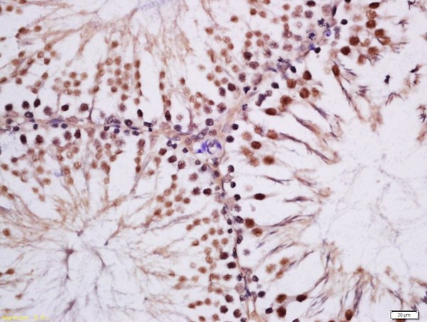Formalin-fixed and paraffin embedded rat testis tissue labeled with Rabbit Anti-MAK (Tyr159) Polyclonal Antibody, Unconjugated (bs-18634R) at 1:200 followed by conjugation to the secondary antibody and DAB staining