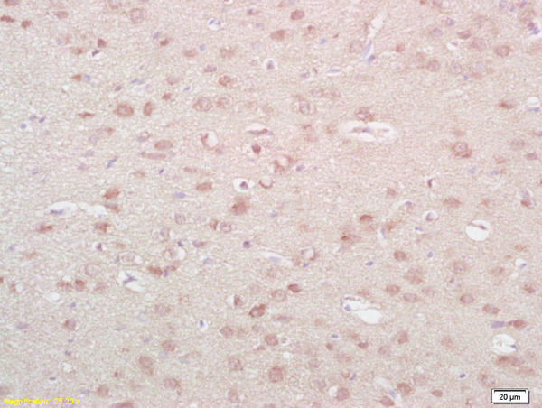 Formalin-fixed and paraffin embedded rat brain labeled with Anti-NKA\/Neurokinin A Polyclonal Antibody, Unconjugated (bs-0069R) at 1:200 followed by conjugation to the secondary antibody and DAB staining