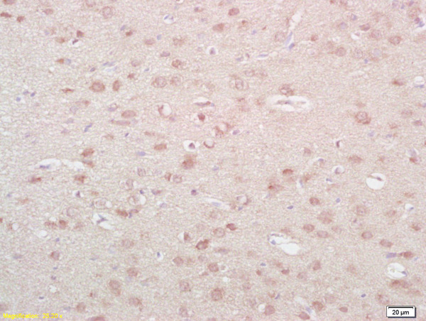 Formalin-fixed and paraffin embedded rat brain labeled with Anti-NKA/Neurokinin A Polyclonal Antibody, Unconjugated (bs-0069R) at 1:200 followed by conjugation to the secondary antibody and DAB staining