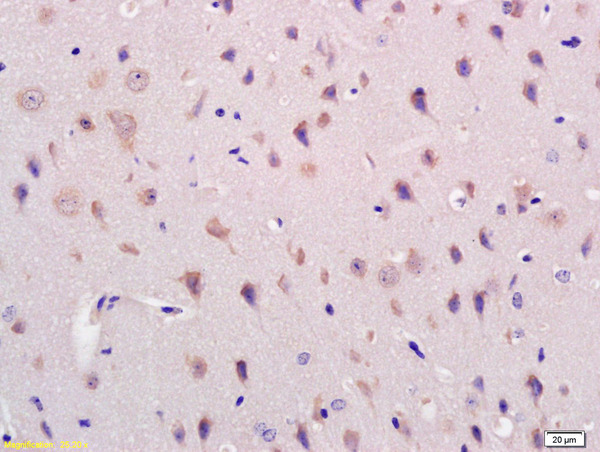 Formalin-fixed and paraffin embedded mouse brain labeled with Rabbit Anti Acylglycerol Kinase Polyclonal Antibody, Unconjugated (bs-6276R) at 1:200 followed by conjugation to the secondary antibody and DAB staining
