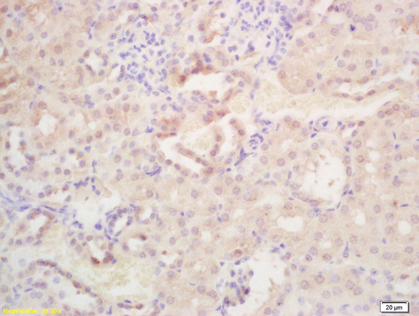 Formalin-fixed and paraffin embedded mouse kidney labeled with Rabbit Anti WISP1 Polyclonal Antibody, Unconjugated (bs-6321R) at 1:200 followed by conjugation to the secondary antibody and DAB staining