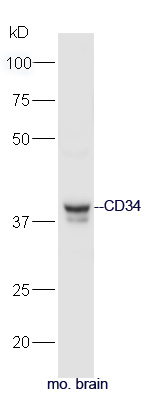 Mouse brain lysates probed with Anti-CD34 Polyclonal Antibody, Unconjugated (bs-0646R) at 1:3200 in 4˚C. Followed by conjugation to secondary antibody (bs-0295G-HRP) at 1:5000 90min in 37˚C.