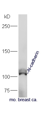 Mouse breast cancer lysates probed with Anti-N-cadherin Polyclonal Antibody, Unconjugated (bs-1172R) at 1:300 in 4˚C. Followed by conjugation to secondary antibody (bs-0295G-HRP) at 1:5000 90min in 37˚C.