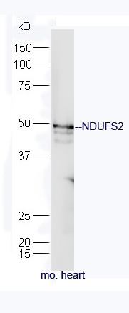 Mouse heart lysates probed with Rabbit Anti-NDUFS2 Polyclonal Antibody, Unconjugated (bs-10455R) at 1:300 overnight at 4˚C. Followed by a conjugated secondary antibody (bs-0295G-HRP) at 1:5000 for 90 min at 37˚C.