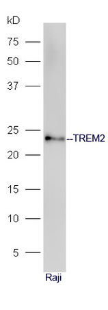 Raje cell lysates probed with Anti-TREM2 Polyclonal Antibody, Unconjugated (bs-2723R) at 1:300 in 4˚C. Followed by conjugation to secondary antibody (bs-0295G-HRP) at 1:5000 90min in 37˚C.