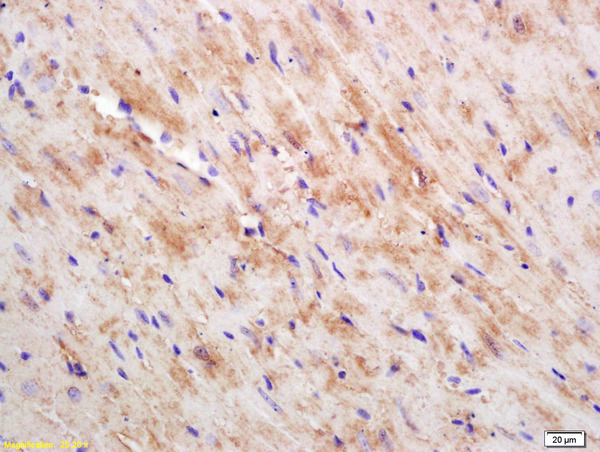 Formalin-fixed and paraffin embedded mouse heart labeled with Rabbit Anti CKMT/Creatine kinase MT Polyclonal Antibody, Unconjugated (bs-6522R) at 1:200 followed by conjugation to the secondary antibody and DAB staining