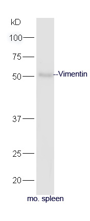 Mouse spleen lysates probed with Anti-Vimentin Polyclonal Antibody, Unconjugated (bs-0756R) at 1:300 in 4˚C. Followed by conjugation to secondary antibody (bs-0295G-HRP) at 1:5000 90min in 37˚C